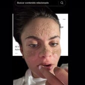 La tiktoker Tia Zakher se ha pasado varias semanas sin lavarse la cara
